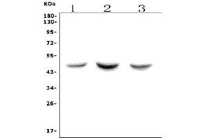 Western blot analysis of ASAH1 using anti-ASAH1 antibody (ABIN7602206). (ASAH1 antibody  (AA 63-393))