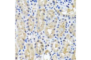 Immunohistochemistry of paraffin-embedded mouse kidney using SNAP29 antibody at dilution of 1:100 (x40 lens).