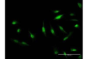Immunofluorescence of monoclonal antibody to CAND1 on HeLa cell. (CAND1 antibody  (AA 1-100))