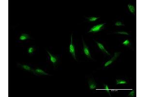 Immunofluorescence of monoclonal antibody to CAND1 on HeLa cell.