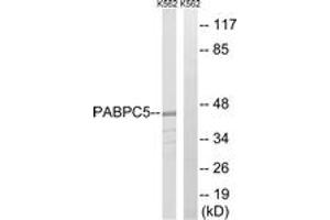 Western blot analysis of extracts from K562 cells, using PABPC5 Antibody. (PABPC5 antibody  (AA 184-233))