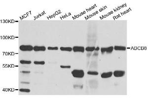Western blot analysis of extracts of various cell lines, using ABCB8 antibody. (ABCB8 antibody  (AA 469-718))