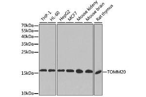 Western blot analysis of extracts of various cell lines, using TOMM20 antibody. (TOMM20 antibody  (AA 20-145))