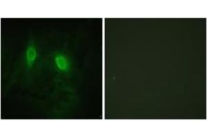 Immunofluorescence (IF) image for anti-Inhibitor of kappa Light Polypeptide Gene Enhancer in B-Cells, Kinase gamma (IKBKG) (AA 51-100) antibody (ABIN1532742)