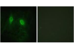 Immunofluorescence analysis of HeLa cells, using IKK-gamma (Ab-85) Antibody. (IKBKG antibody  (AA 51-100))