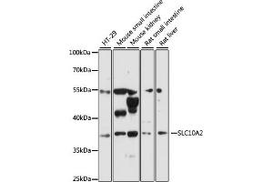 Western blot analysis of extracts of various cell lines, using SLC10 antibody (ABIN6130693, ABIN6147837, ABIN6147838 and ABIN6216622) at 1:3000 dilution. (SLC10A2 antibody  (AA 289-348))