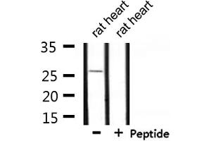 Western blot analysis of extracts from rat heart, using UBTD2 Antibody. (UBTD2 antibody  (C-Term))