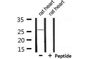 Western blot analysis of extracts from rat heart, using UBTD2 Antibody. (UBTD2 antibody  (C-Term))