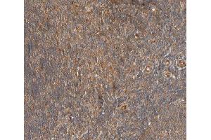 ABIN6267403 at 1/200 staining human lymph node tissue sections by IHC-P. (Phospholipase C gamma 2 antibody  (pTyr753))