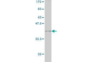 Western Blot detection against Immunogen (36. (MLLT10 antibody  (AA 695-793))