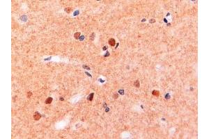 ABIN190775 (2µg/ml) staining of paraffin embedded Human Brain. (CD11b antibody  (Internal Region))