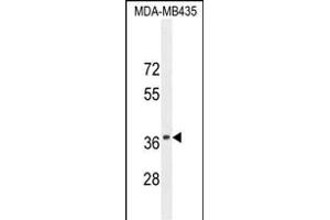 CADM1 Antibody (N-term) (ABIN654660 and ABIN2844356) western blot analysis in MDA-M cell line lysates (35 μg/lane). (CADM1 antibody  (N-Term))