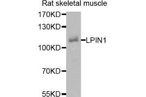 Western blot analysis of extracts of rat skeletal muscle cells, using LPIN1 antibody. (Lipin 1 antibody)