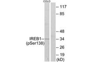 Western Blotting (WB) image for anti-Aconitase 1 (ACO1) (AA 106-155), (pSer138) antibody (ABIN1531675) (Aconitase 1 antibody  (pSer138))