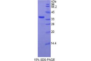 SDS-PAGE analysis of Rat TERT Protein. (TERT Protein)