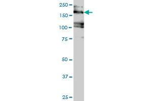 EIF4G3 monoclonal antibody (M02), clone 1D7 Western Blot analysis of EIF4G3 expression in Jurkat . (EIF4G3 antibody  (AA 1-515))