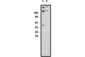 Image no. 1 for anti-Zinc Finger Protein GLI1 (GLI1) antibody (ABIN793724) (GLI1 antibody)