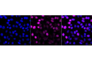 Immunocytochemical staining of HepG2 cells with Phospho-Nucleolin (T76) antibody(ABIN7799669), 1:1,000).