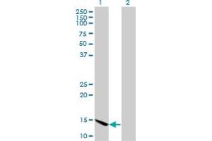Western Blot analysis of CHRAC1 expression in transfected 293T cell line by CHRAC1 monoclonal antibody (M11), clone 4E7. (CHRAC1 antibody  (AA 1-96))