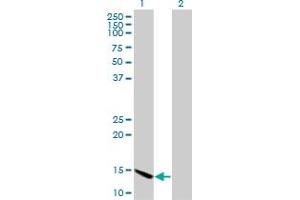 Western Blot analysis of CHRAC1 expression in transfected 293T cell line by CHRAC1 monoclonal antibody (M11), clone 4E7.