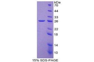 SDS-PAGE (SDS) image for Laminin, beta 3 (LAMB3) (AA 30-222) protein (His tag) (ABIN2125598) (Laminin beta 3 Protein (AA 30-222) (His tag))