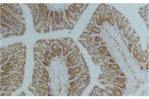Immunohistochemistry of paraffin-embedded Mouse colon tissue using AMPK alpha1 Monoclonal Antibody at dilution of 1:200. (PRKAA1 antibody)