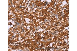 Immunohistochemistry of Human brain  using DCBLD2 Polyclonal Antibody at dilution of 1:50