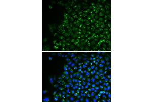 Immunofluorescence (IF) image for anti-Pyruvate Dehydrogenase (Lipoamide) alpha 1 (PDHA1) (AA 30-390) antibody (ABIN6219032) (PDHA1 antibody  (AA 30-390))