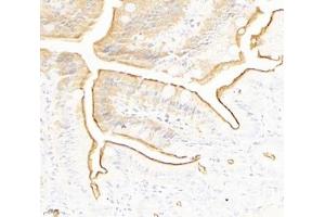 Immunohistochemistry analysis of paraffin-embedded mouse small intestine using PLS1 (ABIN7075096) at dilution of 1: 2000 (PLS1 antibody)