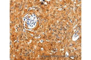 Immunohistochemistry of Human tonsil using NCOR1 Polyclonal Antibody at dilution of 1:100