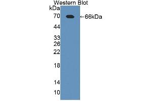 Western blot analysis of the recombinant protein. (TLR5 antibody  (AA 327-646))