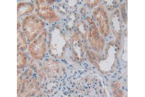 Used in DAB staining on fromalin fixed paraffin- embedded Kidney tissue (IL1A antibody  (AA 98-271))