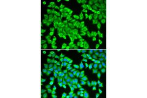 Immunofluorescence analysis of HeLa cells using STIP1 antibody (ABIN6133089, ABIN6148592, ABIN6148593 and ABIN6218351). (STIP1 antibody  (AA 1-300))