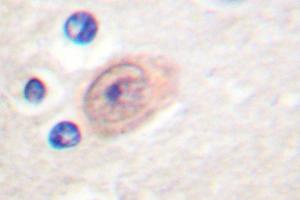 Image no. 1 for anti-CSE1 Chromosome Segregation 1-Like (CSE1L) antibody (ABIN265374)