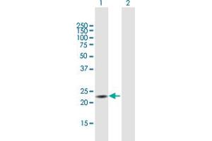 Western Blot analysis of TXNDC9 expression in transfected 293T cell line by TXNDC9 MaxPab polyclonal antibody. (TXNDC9 antibody  (AA 1-188))