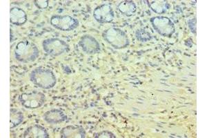 Immunohistochemistry of paraffin-embedded human small intestine tissue using ABIN7162803 at dilution of 1:100 (PPID antibody  (AA 161-370))