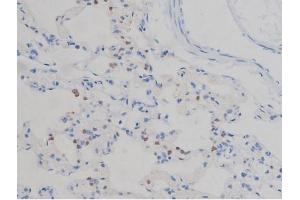 ABIN6267335 at 1/200 staining Rat lung tissue sections by IHC-P. (IGF1R antibody  (pTyr1165, pTyr1166))