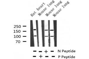 Western blot analysis of Phospho-IGF1R (Tyr1346) expression in various lysates (IGF1R antibody  (pTyr1346))