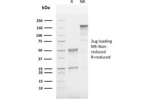 SDS-PAGE Analysis Purified CD63 Mouse Monoclonal Antibody (LAMP3/2790). (CD63 antibody  (AA 100-197))