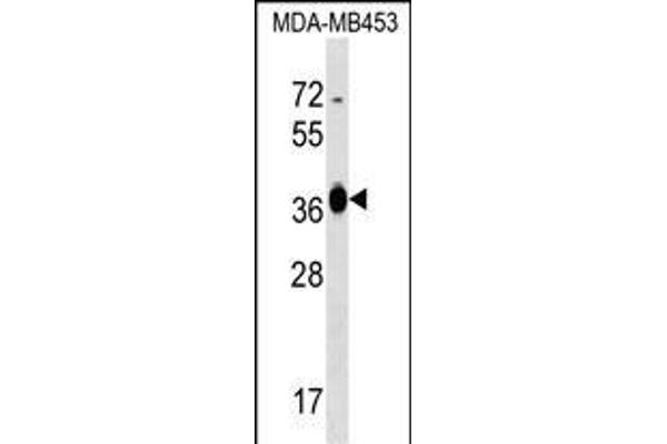 GFOD2 Antikörper  (N-Term)