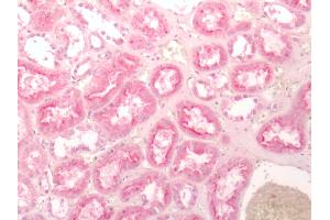 Human Kidney: Formalin-Fixed, Paraffin-Embedded (FFPE) (FZD2 antibody  (Extracellular Domain))