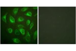 Immunofluorescence analysis of HeLa cells, using Calnexin (Ab-583) Antibody. (Calnexin antibody  (AA 543-592))