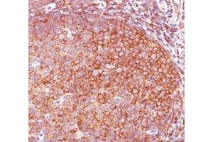 IHC staining of human tonsil with Bcl10 antibody (BL10/411). (BCL10 antibody  (AA 122-168))