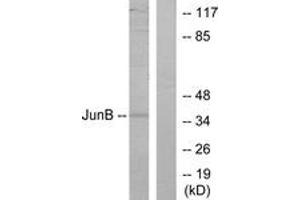 Western blot analysis of extracts from HeLa cells, using JunB (Ab-259) Antibody. (JunB antibody  (AA 226-275))