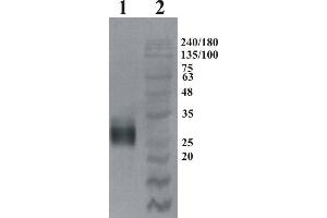 Western Blotting (WB) image for anti-GDNF Family Receptor alpha 4 (GFRA4) antibody (ABIN1450233) (GFRA4 antibody)