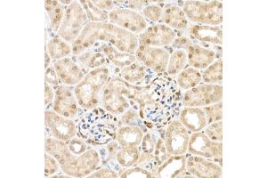 Immunohistochemistry (IHC) image for anti-WW Domain Containing Transcription Regulator 1 (WWTR1) (AA 1-230) antibody (ABIN6150278)