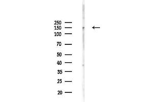 Western blot analysis of lysates from Mouse testis, using R Antibody at 1/1000 dilution.