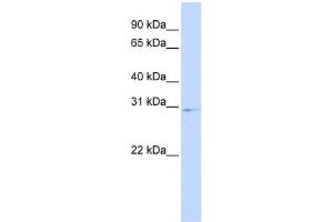 WB Suggested Anti-HOXA9 Antibody Titration:  0. (HOXA9 antibody  (Middle Region))