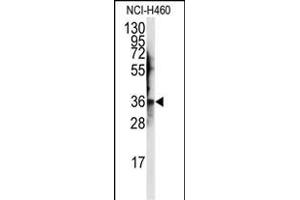 Western blot analysis of anti-JTV1 Antibody (Center) (ABIN389383 and ABIN2839480) in NCI- cell line lysates (35 μg/lane). (AIMP2 antibody  (AA 156-184))