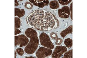 Immunohistochemical staining (Formalin-fixed paraffin-embedded sections) of human kidney with NAPRT1 monoclonal antibody, clone CL0366  shows strong cytoplasmic immunoreactivity in renal tubules. (NAPRT1 antibody)